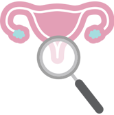 Ung thư cổ tử cung xảy ra ở cổ tử cung, phần dưới của tử cung.